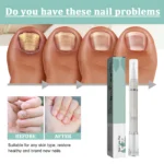 Nail Fungus Treatment Pen 4ml Amz Wx2m4767 4