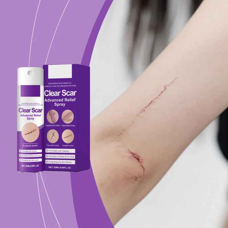 Scar Care Spray 20ml Reduce Scar Visibility Smoothing Amz Cckeeyyv 2